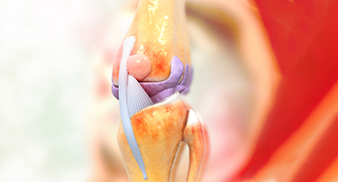 Things to Know Before Your Knee Replacement Surgery