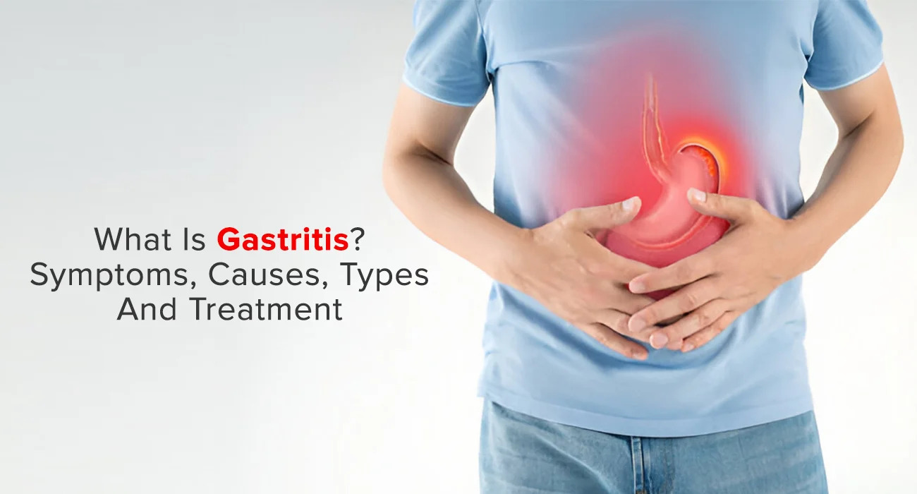 What Is Gastritis? Symptoms, Causes, Types and Treatment
