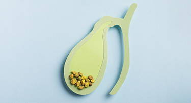 Can Gallbladder Stones Be Removed Without Surgery?