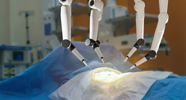 When Is Robotic Hysterectomy Recommended? Conditions & Eligibility Surgery